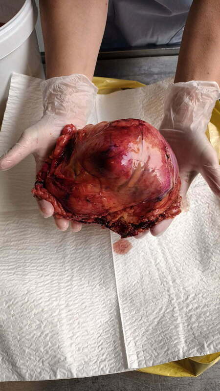 On dirait pas, mais c'est censé être un rein