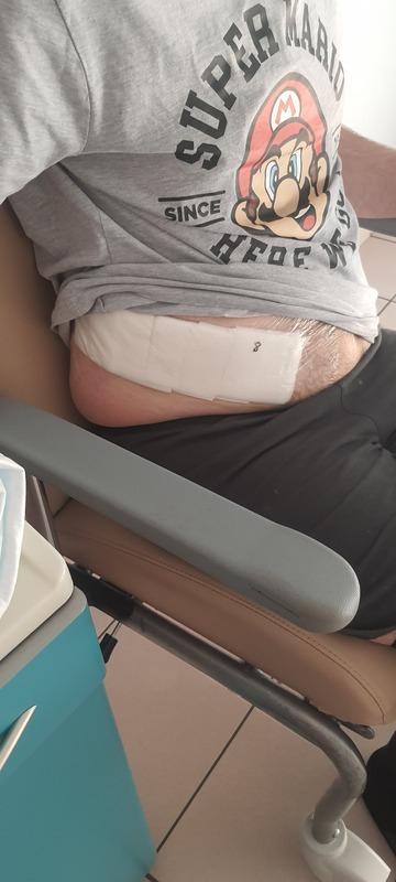 La cicatrice faisait dans les 20cm. On sent qu'il a dû mettre les 2 mains dedans…